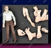 9. Tê tay chân, yếu liệt, rối loạn cảm giác